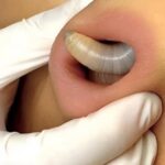RED DOTS ON YOUR SKIN: CAUSES AND WHAT THEY MIGHT REPRESENT